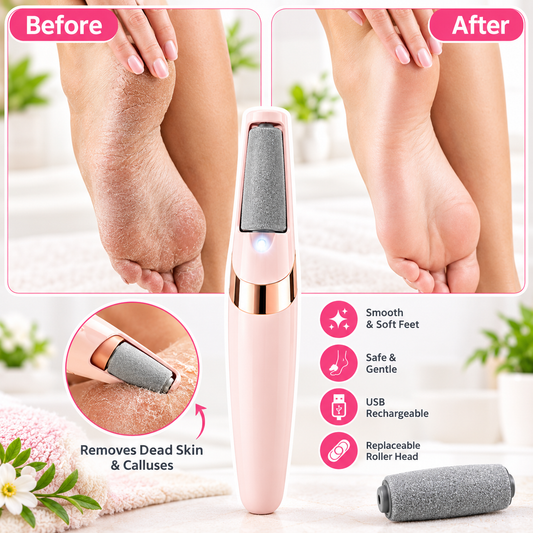 Electric Foot File for Cracked Heels – Rechargeable Callus Remover & Dead Skin Remover